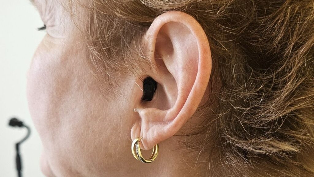 aparelho auditivo para zumbido_
