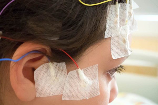 exame otoneurologico completo preparacao exame